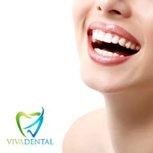 Viva Dental Piercings