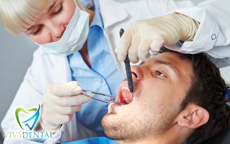 Mundhöhlenkrebs - der Tumor im Mund | Viva Dental